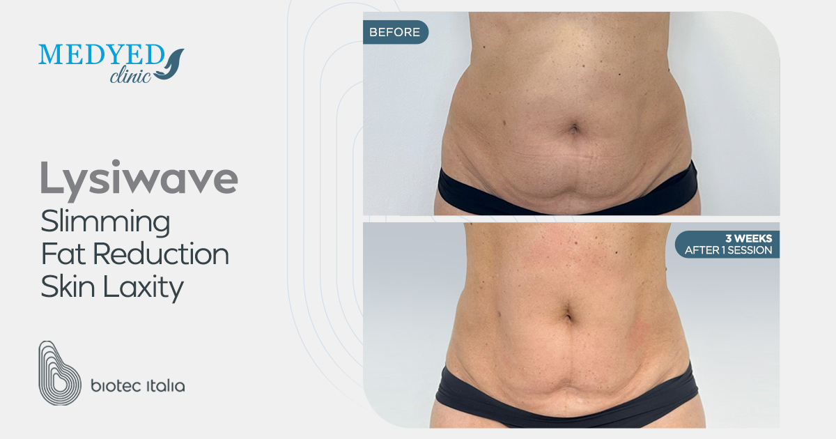 عيادة Medyed تجربة شاملة للعلاجات التجميلية والعافية المتقدمة